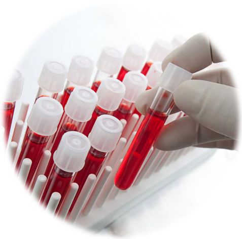 Клинико-биохимический анализ крови