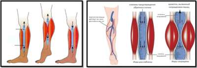 Анатомия мышц голени во время движения