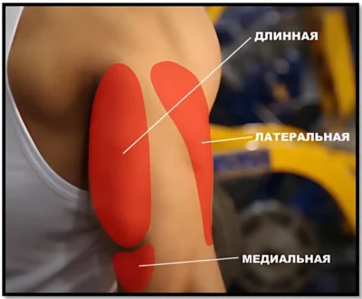 строение трицепса трицепс анатомия