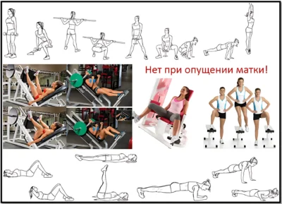 какие упражнения нельзя делать при опущении матки