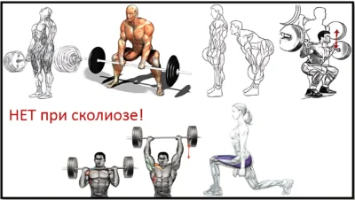 какие упражнения нельзя делать при сколиозе