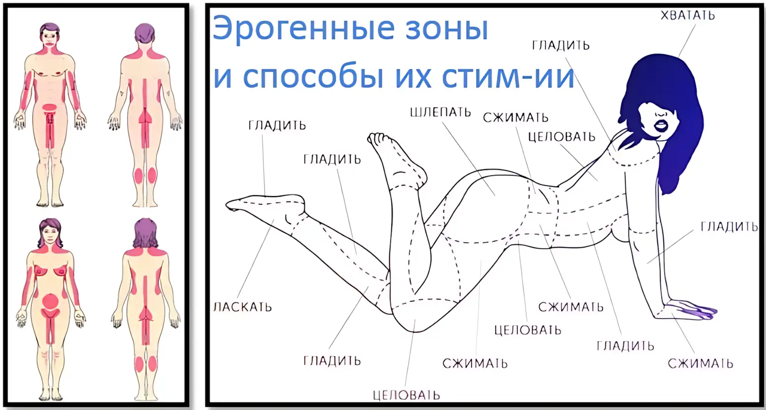 erogennyie-zonyi