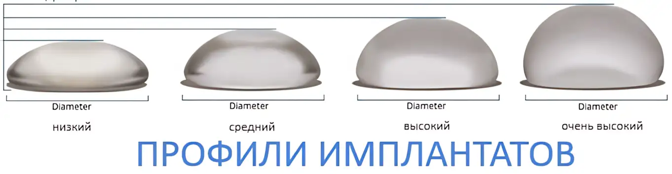 profili-implantatov
