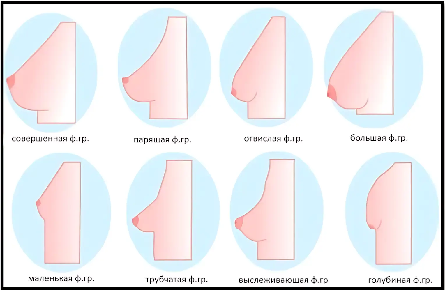 различные формы женской груди, классификация