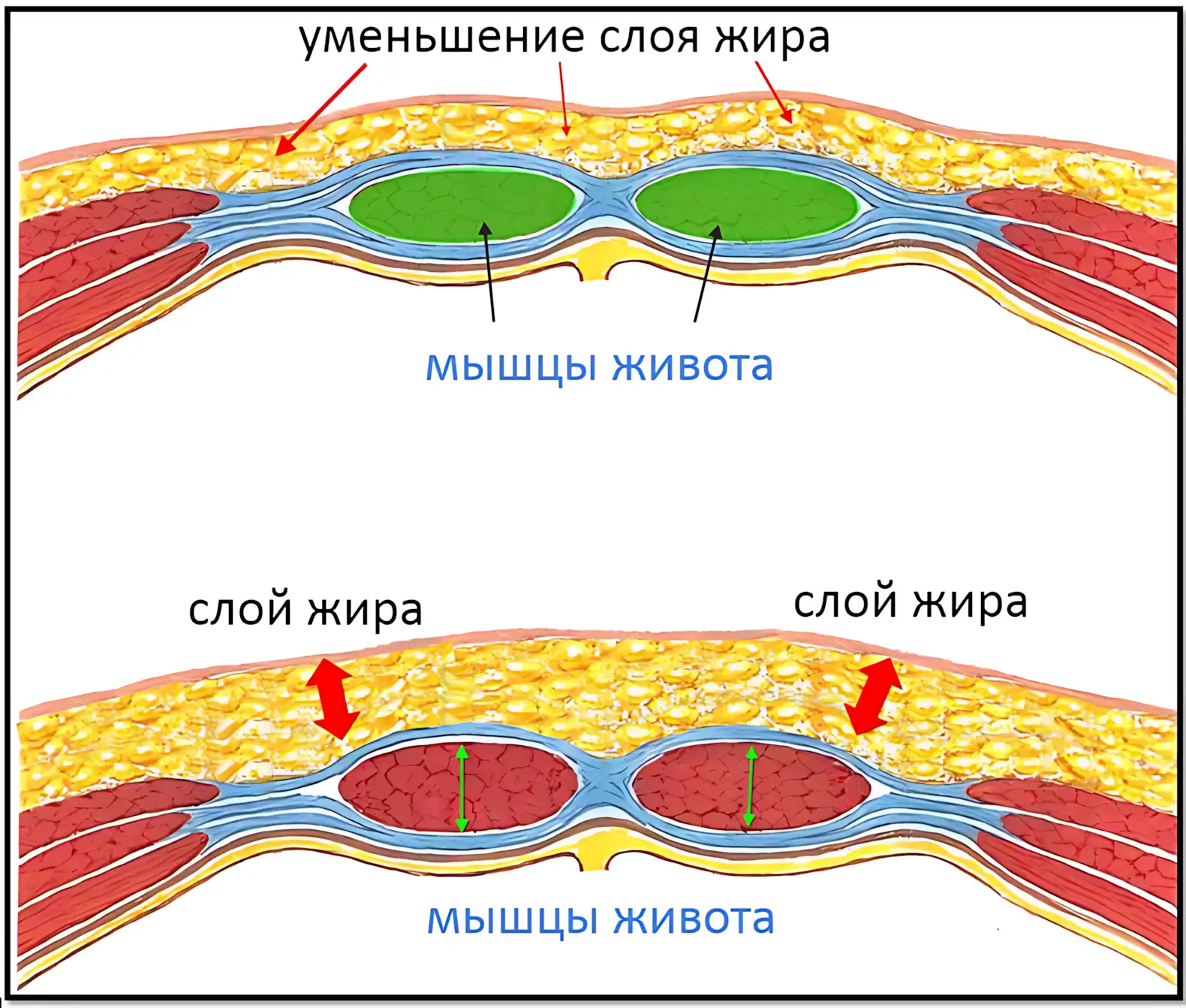 слой жира и мышцы, как похудеть