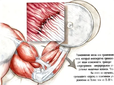 как рвутся мышц, микротравмы мышц kak-rvutsya-myshcz-mikrotravmy-myshcz