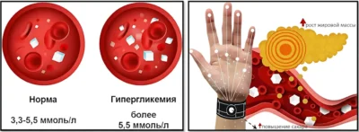 к чему приводит прием высокоуглеводистого гейнера - накоплению жира k-chemu-privodit-priem-vysokouglevodistogo-gejnera-nakopleniyu-zhira