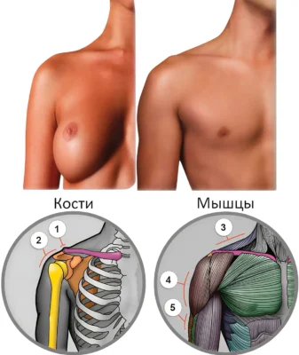 силуэт плеча кости и мышцы